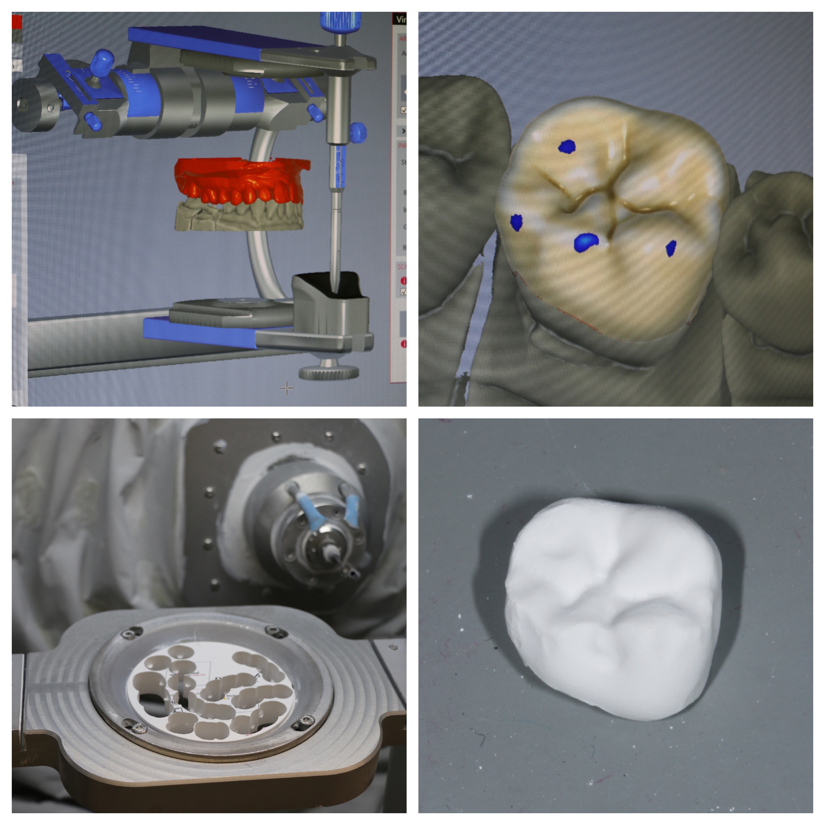 CAD CAM Schlee Dental cad-cam-schlee-dental